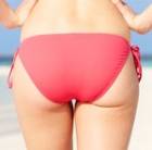 cellulite