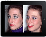 plastic surgery app