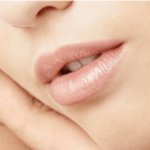lip lift